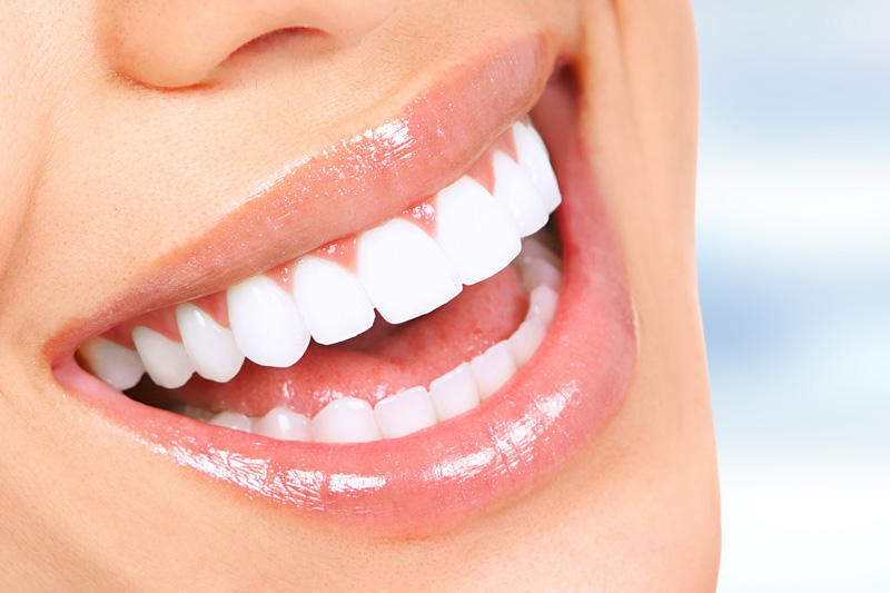 Cosmetic Dentistry in Riverside